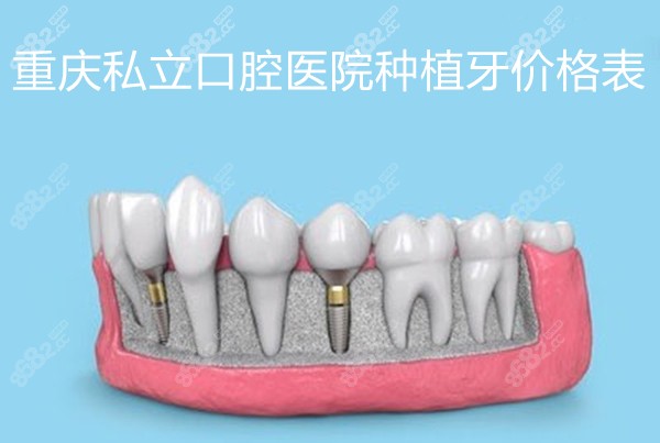 重庆私立口腔医院种植牙价格表