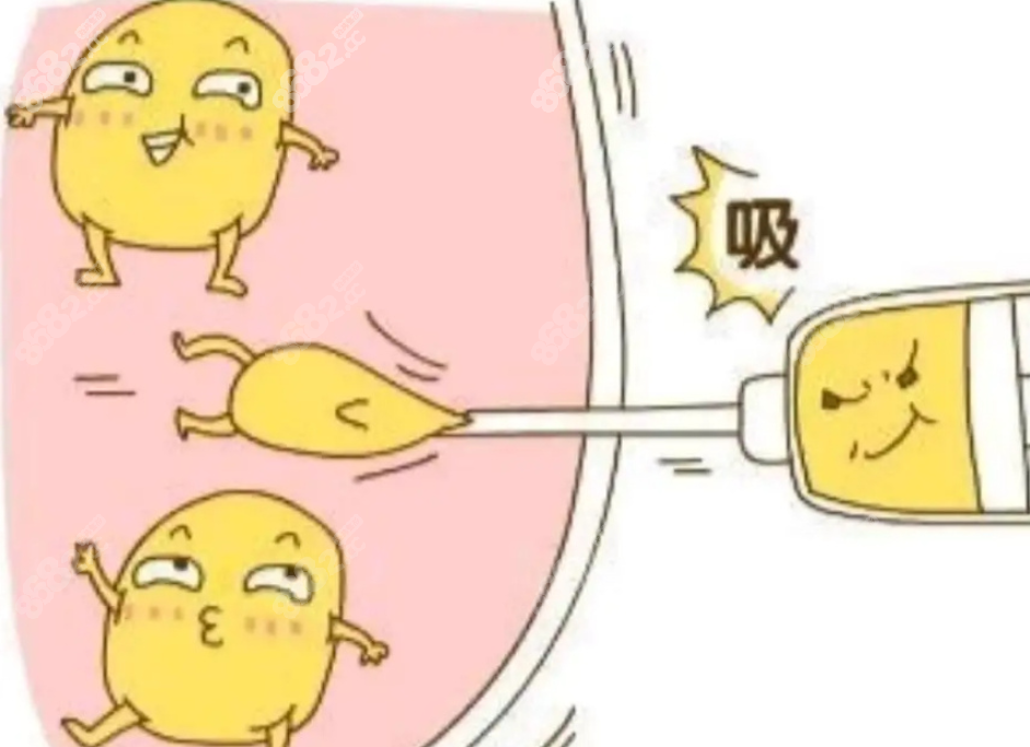 廣州軍美王娜抽脂怎么樣