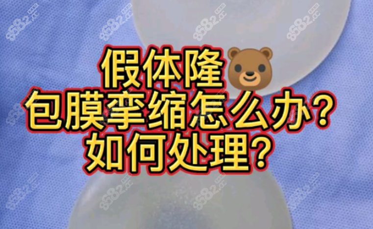 隆胸包膜挛缩一定要取出来吗