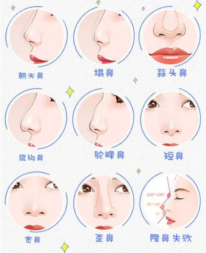 李劲良鼻修复怎么样