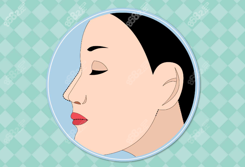 李劲良和<!--<i data=20240705-sp></i>-->哪个好