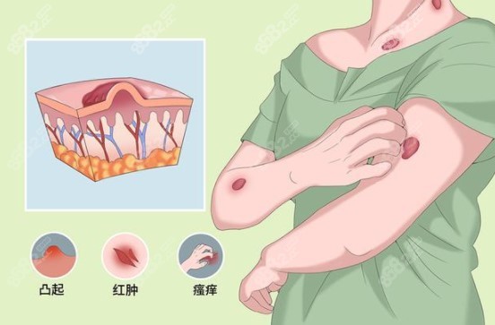 做srt-100治疗瘢痕好的医院m.8682.cc