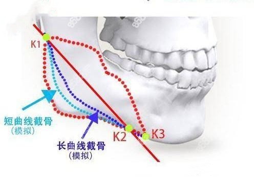 武汉中翰整形口碑好吗？