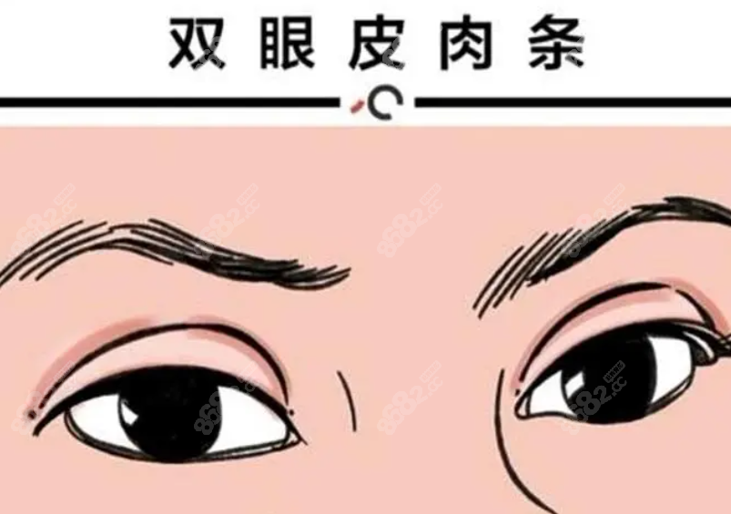 韩国世美和大眼睛医院眼修复哪个好