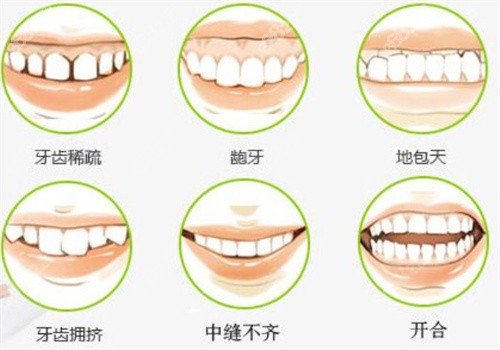 牙齿矫正