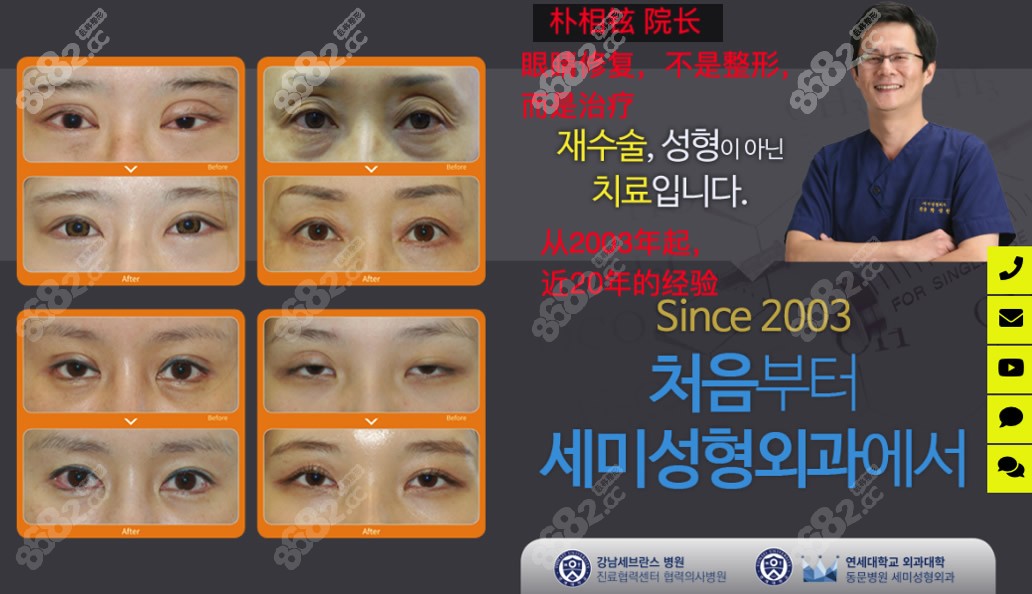 韩国世美整形医院朴相炫医生眼修复怎么样