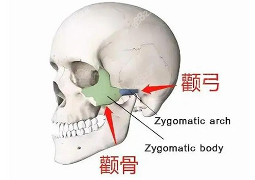 四川友谊整形医院颧骨颧弓