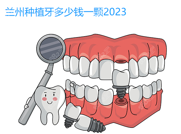 兰州种植牙多少钱一颗2023www.8682.cc