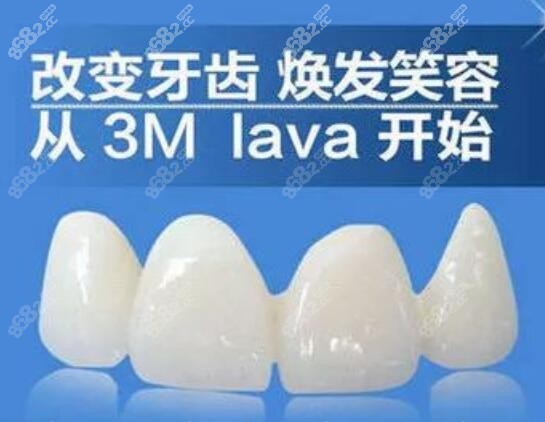 美國全瓷牙冠怎么樣