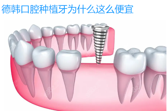 德韩口腔种植牙为什么这么便宜www.8682.cc