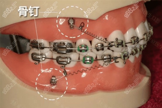 福州维乐口腔正畸医生：苏嘉辉医生
