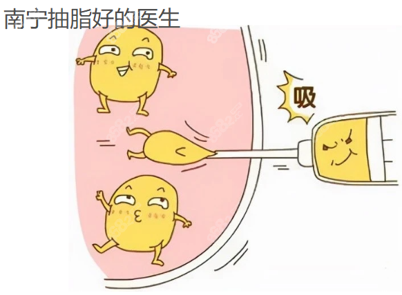 南宁抽脂好的医生www.8682.cc