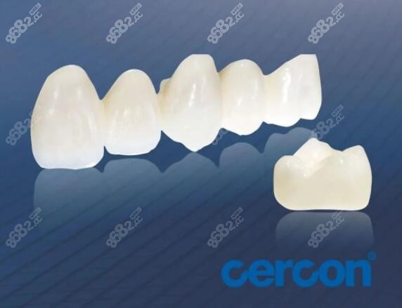 德國全瓷牙冠怎么樣m.8682.cc