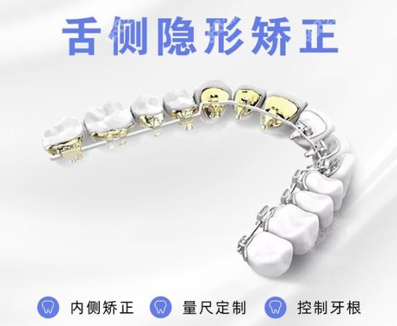 福州维乐口腔牙齿矫正医生：许长记医生