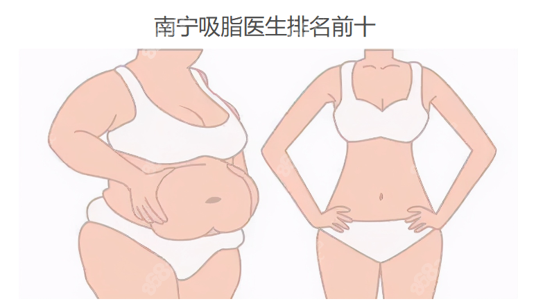 南宁吸脂医生排名前十