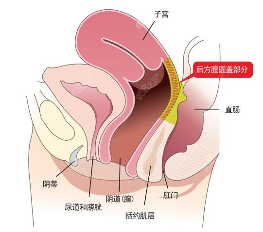 韩国好手艺尹虎珠后方膣圆盖术缩阴