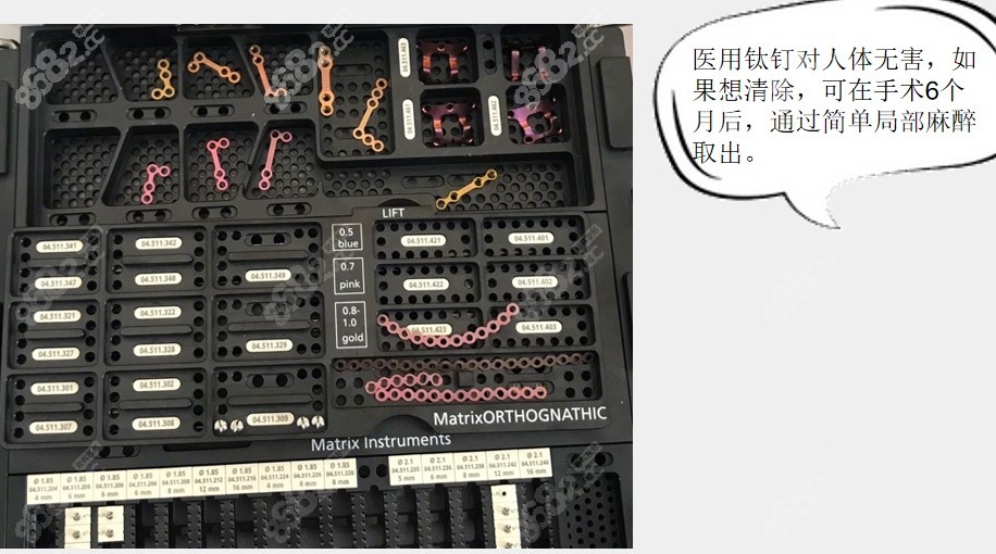 張智勇做顴骨手術(shù)技術(shù)優(yōu)勢(shì) 張智勇做顴骨手術(shù)技術(shù)優(yōu)勢(shì)