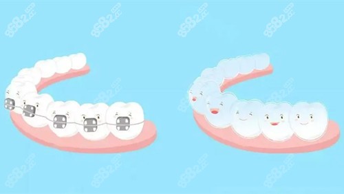 柳州牙齿矫正大概要花费多少钱