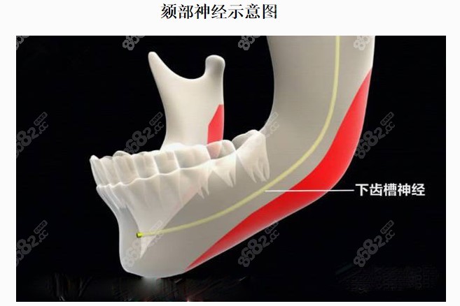 廣州何錦泉正頜手術(shù)做得好