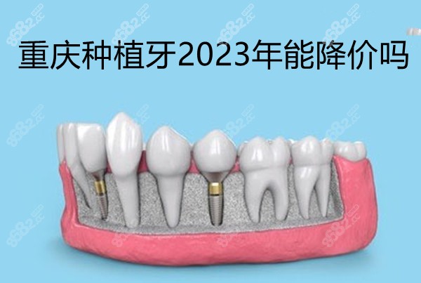 重庆种植牙2023年能降价吗