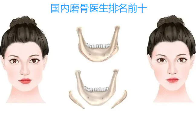 國內(nèi)磨骨醫(yī)生排名前十m.66ub.cn