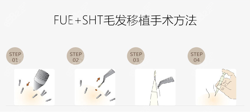 深圳鹏程医院植发技术http://www.8682.cc/