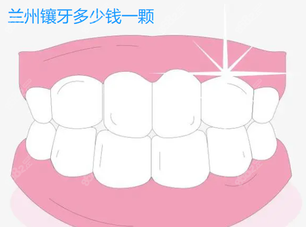 兰州镶牙多少钱一颗