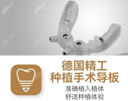 成都布莱梅口腔数字化导板种植牙技术娴熟