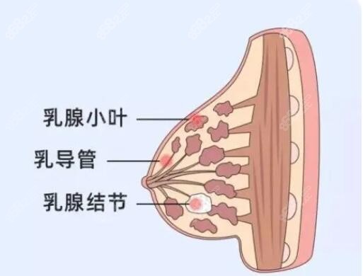 有乳腺增生和结节可以隆胸吗?