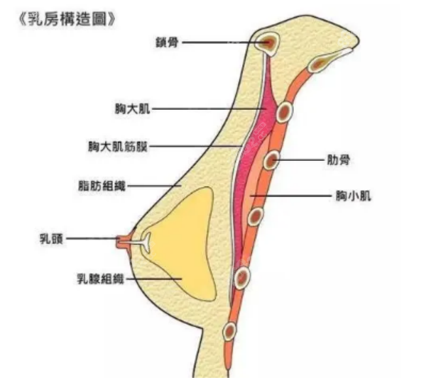 隆胸手术