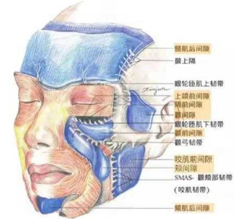 面部提升手术