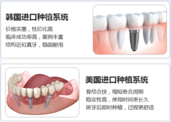 温州全口韩国种植牙多少钱