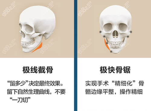 黄大勇轮廓手术特色优势