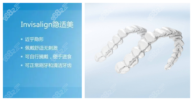 洛阳九龙口腔隐形牙齿矫正