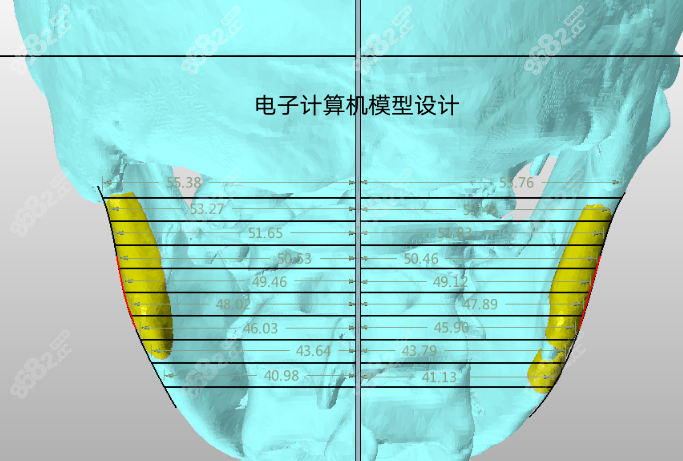 上海时光何晋龙医生磨骨手术做得好