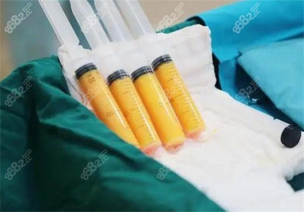 水动力环吸