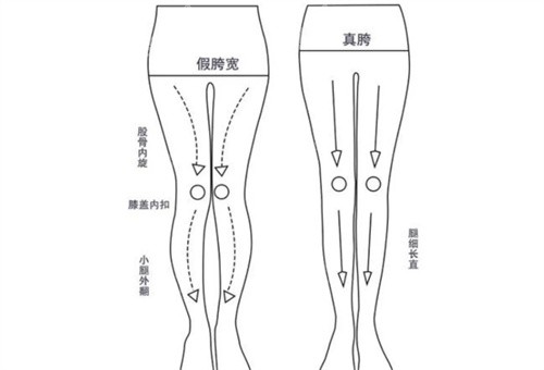 直腿术原理是什么