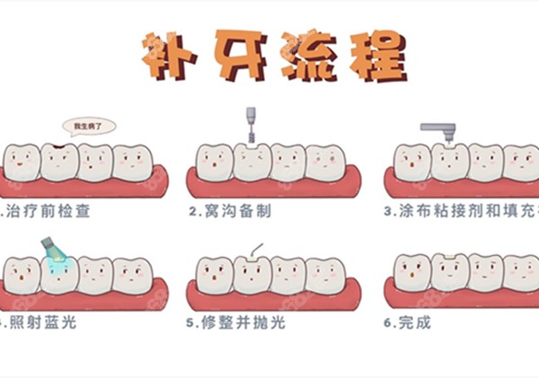 补牙流程图片