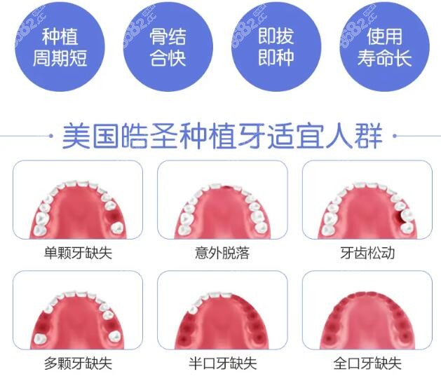 美国晧圣种植体怎么识别真伪呢