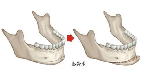 广州柳超医生什么职称