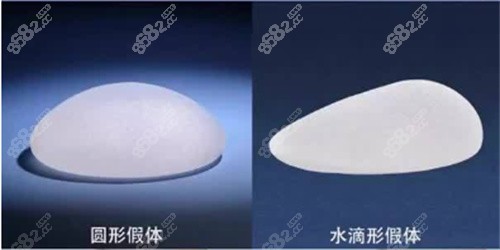 水滴型假体会下垂吗