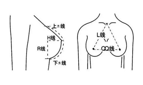 成都米兰柏羽隆胸