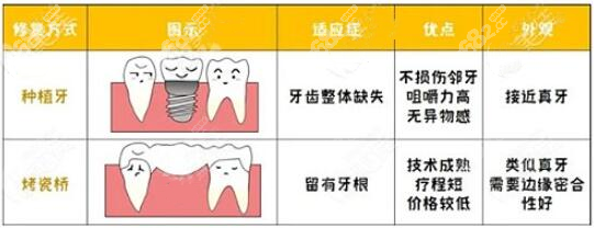 缺牙做3连桥和种植牙哪个好