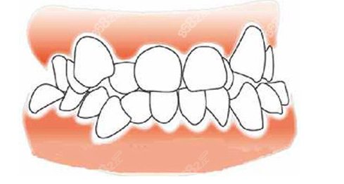 牙颌畸形矫正价格多少钱（m.8682.cc）