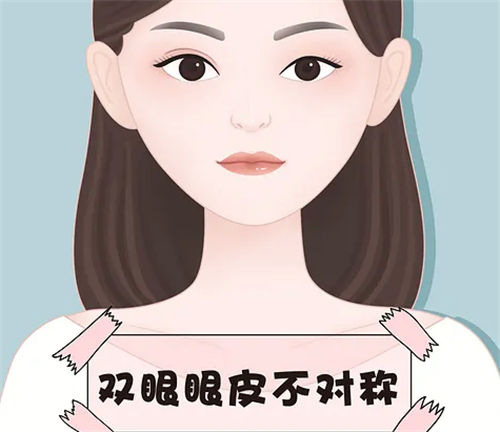 去上海时光整形做眼修复6w起,医生修复双眼皮技术靠谱