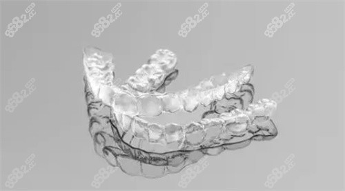 隐形矫正牙套模型图