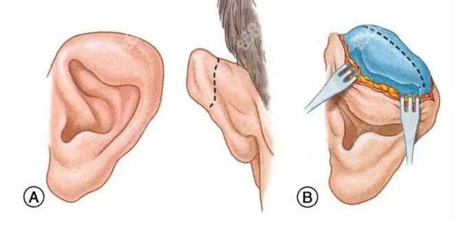 余文林醫(yī)生在哪家醫(yī)院坐診