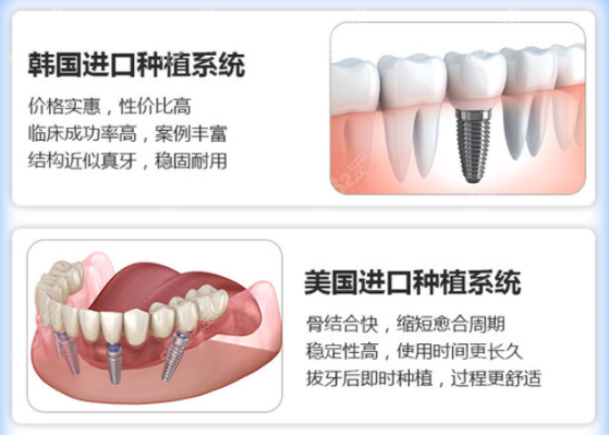 绵阳医博口腔种植牙价格