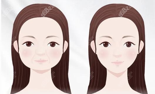 首尔丽丝塔医院做轮廓好