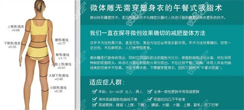 微体雕、3S体雕吸脂术后可不穿塑身衣